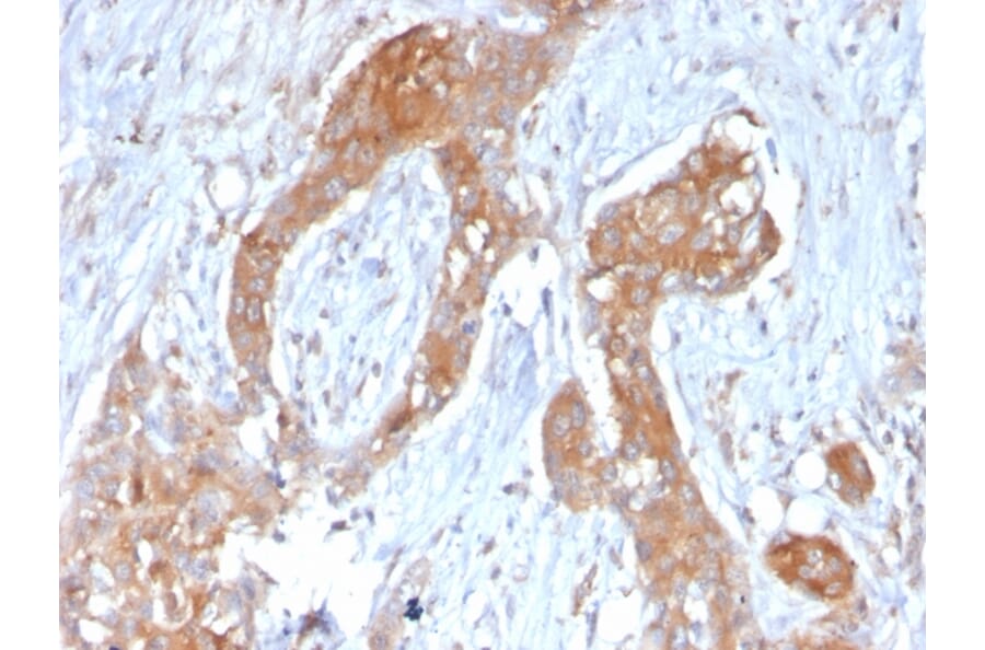 Immunohistochemistry - Anti-TNFAIP3 Antibody [TNFAIP3/2813] - BSA and Azide free (A253337) - Antibodies.com