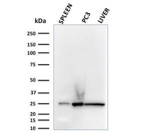Western Blot - Anti-C1QA Antibody [C1QA/2783] - BSA and Azide free (A253339) - Antibodies.com