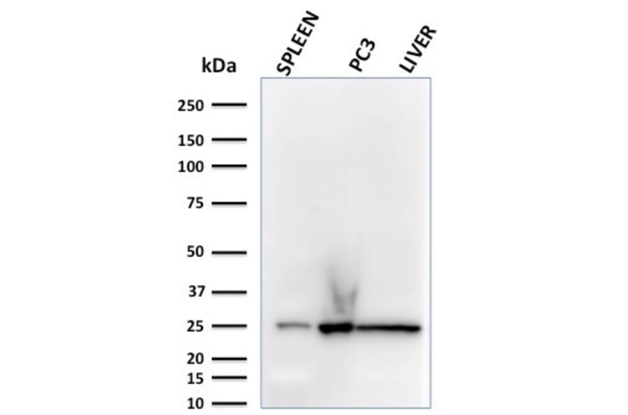 Western Blot - Anti-C1QA Antibody [C1QA/2783] - BSA and Azide free (A253339) - Antibodies.com