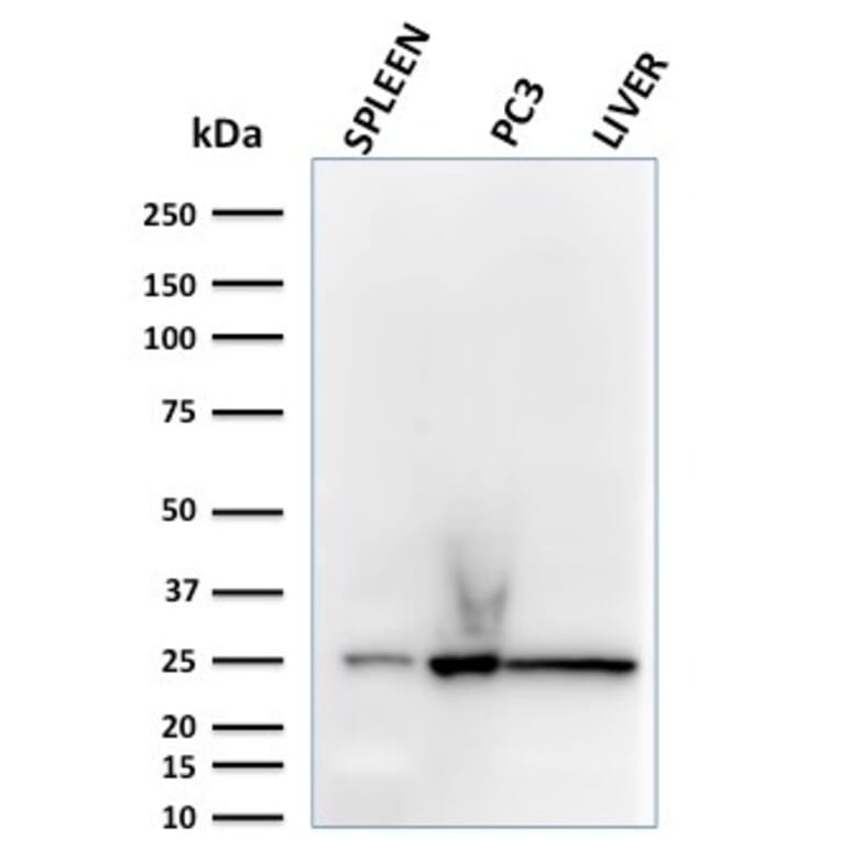 Western Blot - Anti-C1QA Antibody [C1QA/2783] - BSA and Azide free (A253339) - Antibodies.com