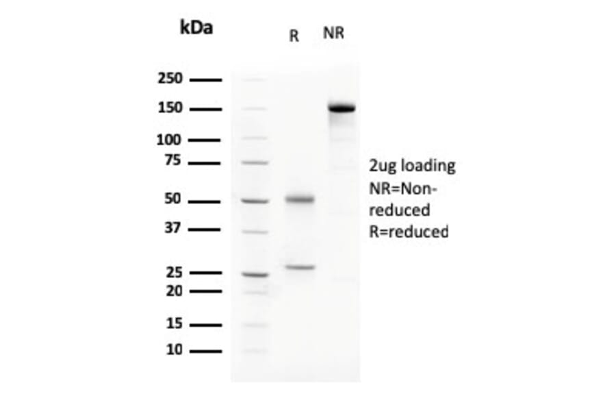 SDS-PAGE - Anti-C1QA Antibody [C1QA/2783] - BSA and Azide free (A253339) - Antibodies.com