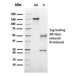 SDS-PAGE - Anti-C1QA Antibody [C1QA/2953] - BSA and Azide free (A253341) - Antibodies.com
