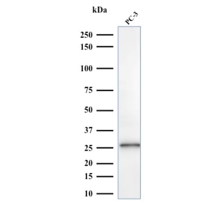 Western Blot - Anti-C1QA Antibody [C1QA/2953] - BSA and Azide free (A253341) - Antibodies.com