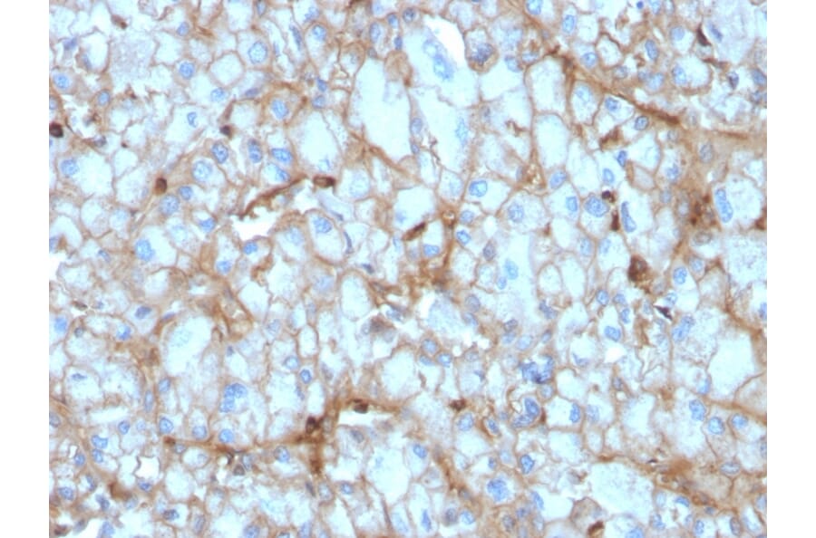 Immunohistochemistry - Anti-C1QA Antibody [C1QA/2954] - BSA and Azide free (A253342) - Antibodies.com