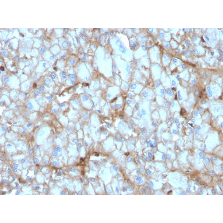 Immunohistochemistry - Anti-C1QA Antibody [C1QA/2954] - BSA and Azide free (A253342) - Antibodies.com