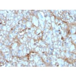 Immunohistochemistry - Anti-C1QA Antibody [C1QA/2954] - BSA and Azide free (A253342) - Antibodies.com