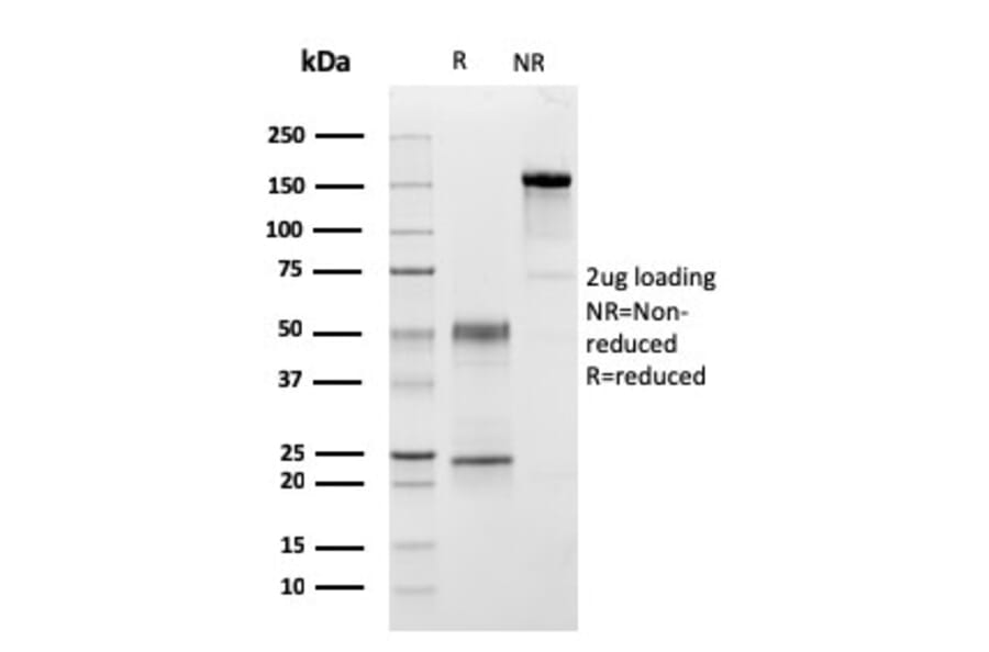 SDS-PAGE - Anti-C1QA Antibody [C1QA/2954] - BSA and Azide free (A253342) - Antibodies.com