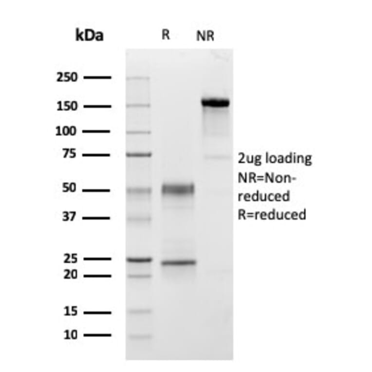 SDS-PAGE - Anti-C1QA Antibody [C1QA/2954] - BSA and Azide free (A253342) - Antibodies.com