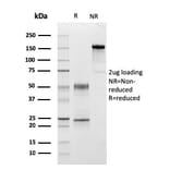 SDS-PAGE - Anti-C1QA Antibody [C1QA/2954] - BSA and Azide free (A253342) - Antibodies.com