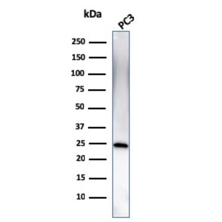 Western Blot - Anti-C1QA Antibody [C1QA/2954] - BSA and Azide free (A253342) - Antibodies.com