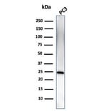 Western Blot - Anti-C1QA Antibody [C1QA/2954] - BSA and Azide free (A253342) - Antibodies.com