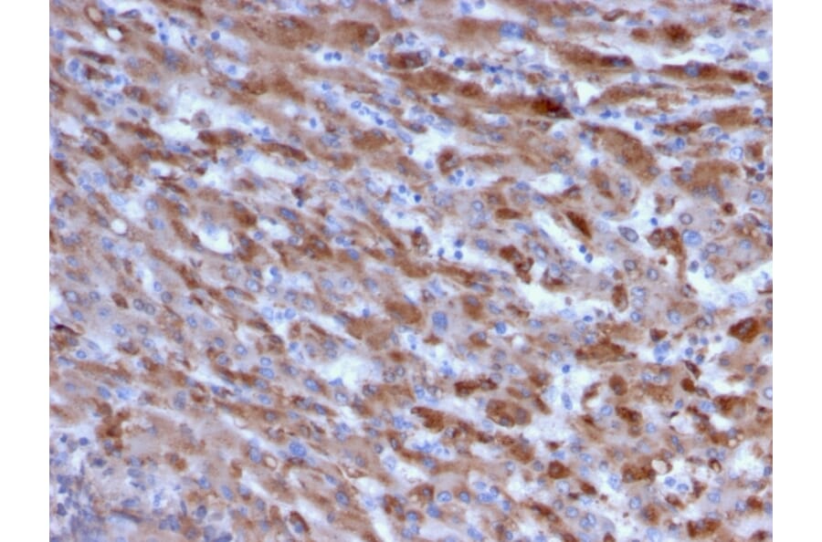 Immunohistochemistry - Anti-C1QA Antibody [C1QA/2955] - BSA and Azide free (A253343) - Antibodies.com