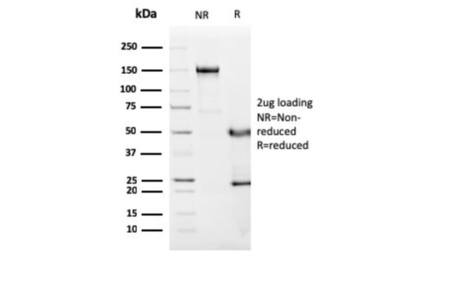 SDS-PAGE - Anti-C1QA Antibody [C1QA/2955] - BSA and Azide free (A253343) - Antibodies.com