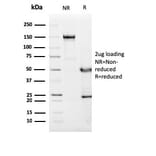 SDS-PAGE - Anti-C1QA Antibody [C1QA/2955] - BSA and Azide free (A253343) - Antibodies.com