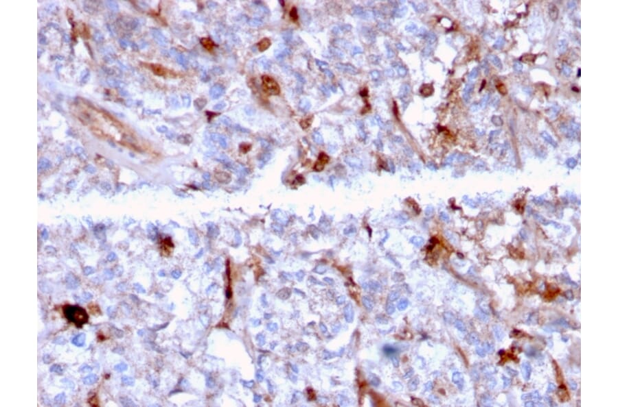 Immunohistochemistry - Anti-C1QA Antibody [C1QA/2956] - BSA and Azide free (A253344) - Antibodies.com