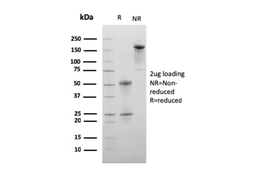 SDS-PAGE - Anti-C1QA Antibody [C1QA/2956] - BSA and Azide free (A253344) - Antibodies.com