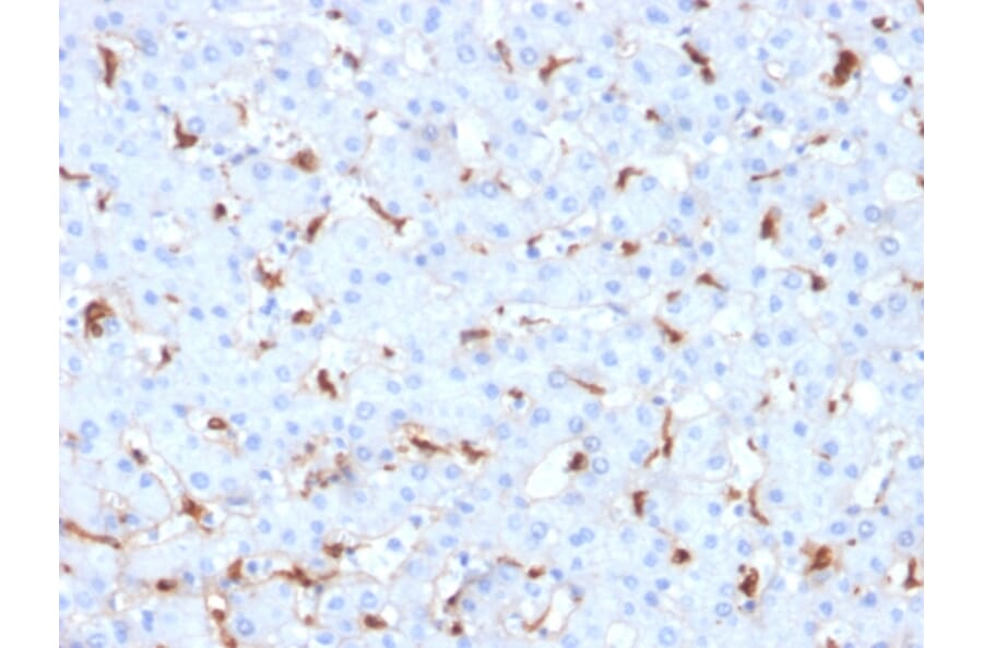 Immunohistochemistry - Anti-C1QB Antibody [C1QB/2961] - BSA and Azide free (A253345) - Antibodies.com
