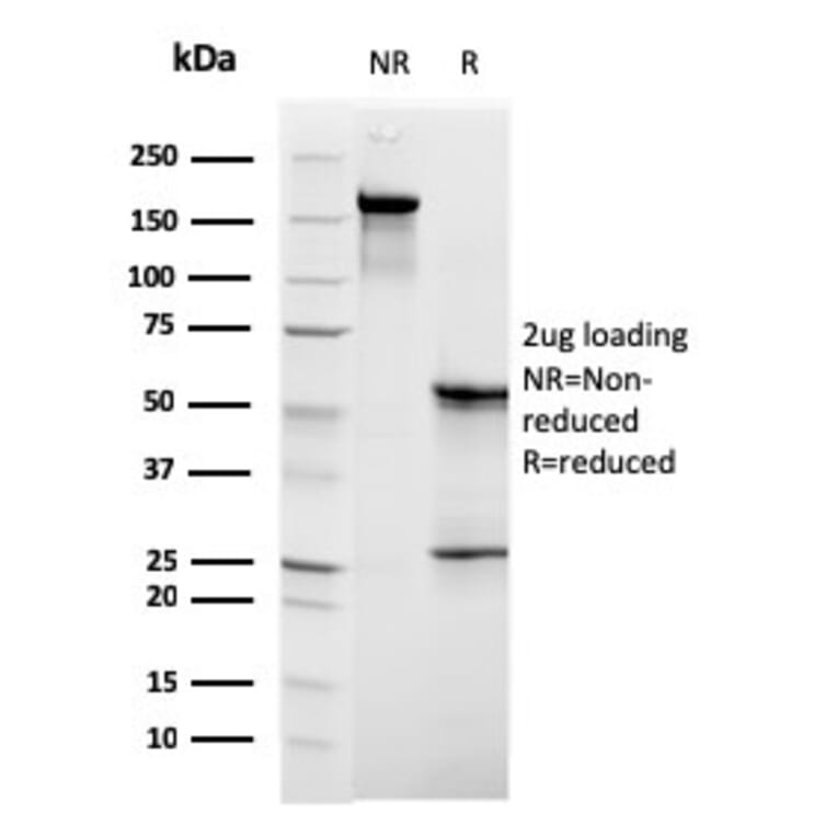 SDS-PAGE - Anti-C1QB Antibody [C1QB/2961] - BSA and Azide free (A253345) - Antibodies.com
