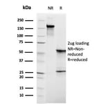 SDS-PAGE - Anti-C1QB Antibody [C1QB/2961] - BSA and Azide free (A253345) - Antibodies.com