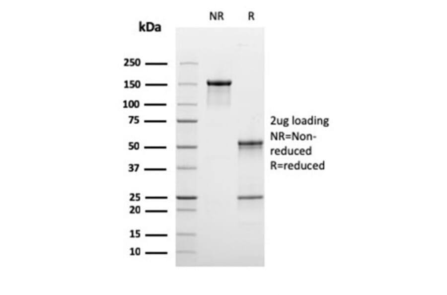 SDS-PAGE - Anti-C1QB Antibody [C1QB/2965] - BSA and Azide free (A253346) - Antibodies.com
