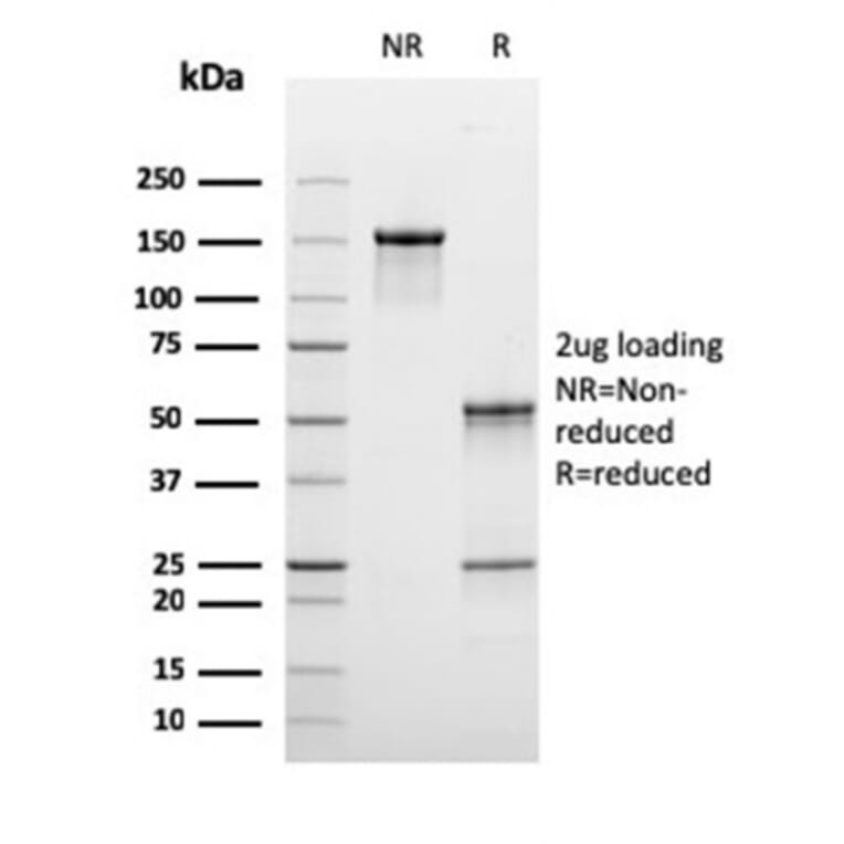 SDS-PAGE - Anti-C1QB Antibody [C1QB/2965] - BSA and Azide free (A253346) - Antibodies.com