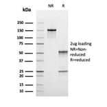 SDS-PAGE - Anti-C1QB Antibody [C1QB/2965] - BSA and Azide free (A253346) - Antibodies.com