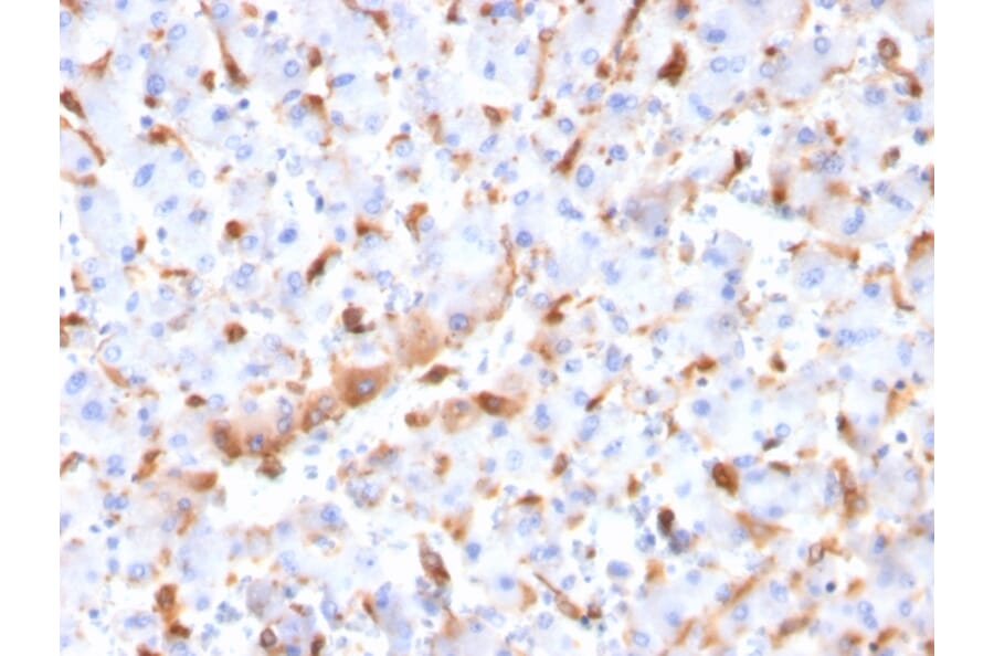 Immunohistochemistry - Anti-C1QB Antibody [C1QB/2966] - BSA and Azide free (A253347) - Antibodies.com
