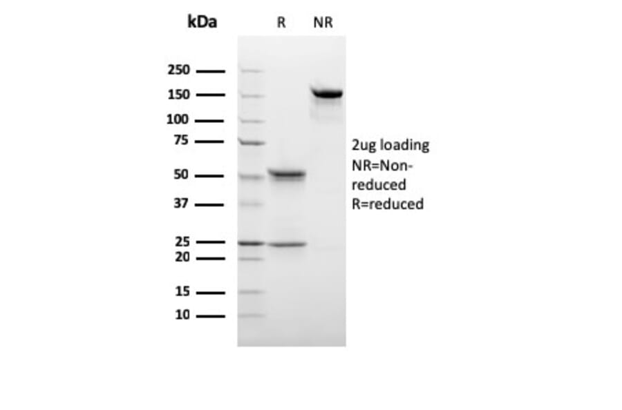 SDS-PAGE - Anti-C1QB Antibody [C1QB/2966] - BSA and Azide free (A253347) - Antibodies.com