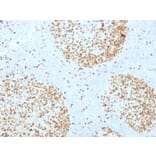 Immunohistochemistry - Anti-Topoisomerase II alpha Antibody [TOP2A/1361] - BSA and Azide free (A253348) - Antibodies.com