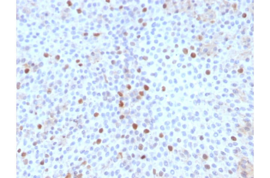 Immunohistochemistry - Anti-Topoisomerase II alpha Antibody [TOP2A/1361] - BSA and Azide free (A253348) - Antibodies.com