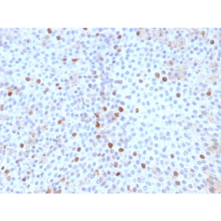 Immunohistochemistry - Anti-Topoisomerase II alpha Antibody [TOP2A/1361] - BSA and Azide free (A253348) - Antibodies.com