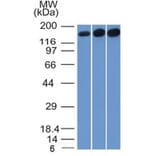Western Blot - Anti-Topoisomerase II alpha Antibody [TOP2A/1361] - BSA and Azide free (A253348) - Antibodies.com
