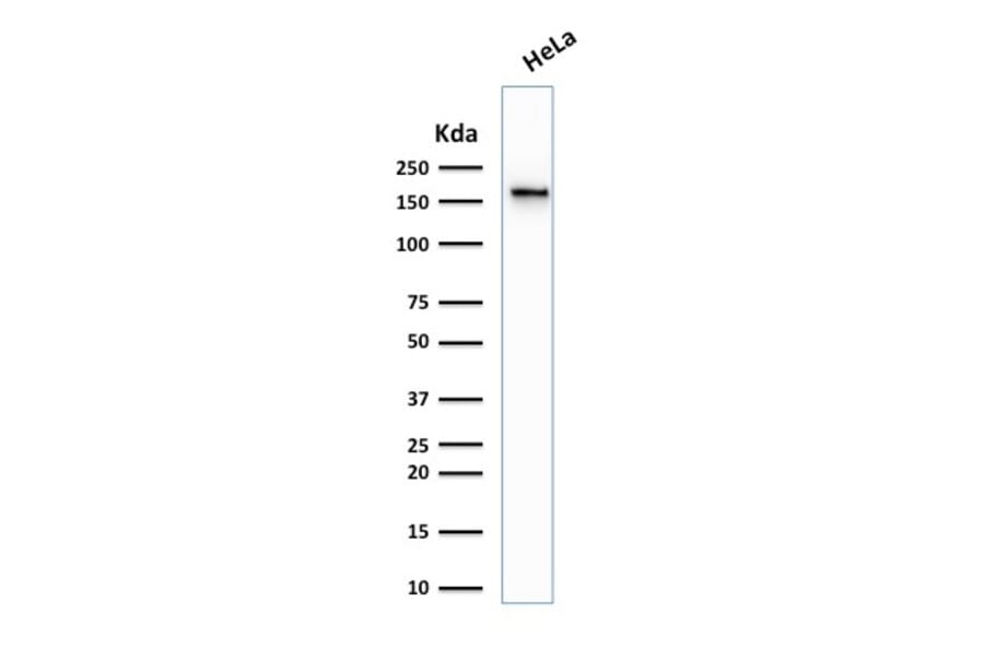 Western Blot - Anti-Topoisomerase II alpha Antibody [TOP2A/1361] - BSA and Azide free (A253348) - Antibodies.com