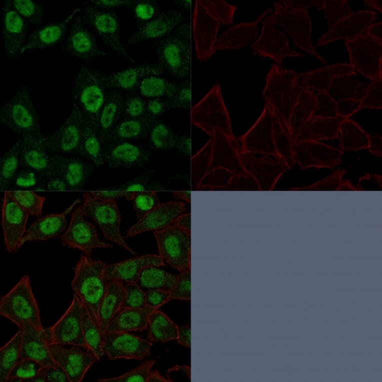 Immunofluorescence - Anti-Topoisomerase II alpha Antibody [TOP2A/1361] - BSA and Azide free (A253348) - Antibodies.com