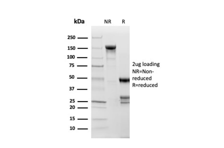 SDS-PAGE - Anti-Topoisomerase II alpha Antibody [TOP2A/1361] - BSA and Azide free (A253348) - Antibodies.com