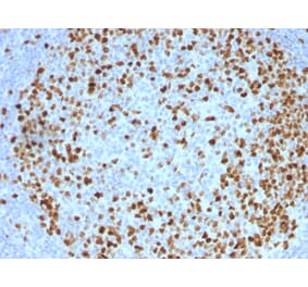 Immunohistochemistry - Anti-Topoisomerase II alpha Antibody [TOP2A/1362] - BSA and Azide free (A253349) - Antibodies.com