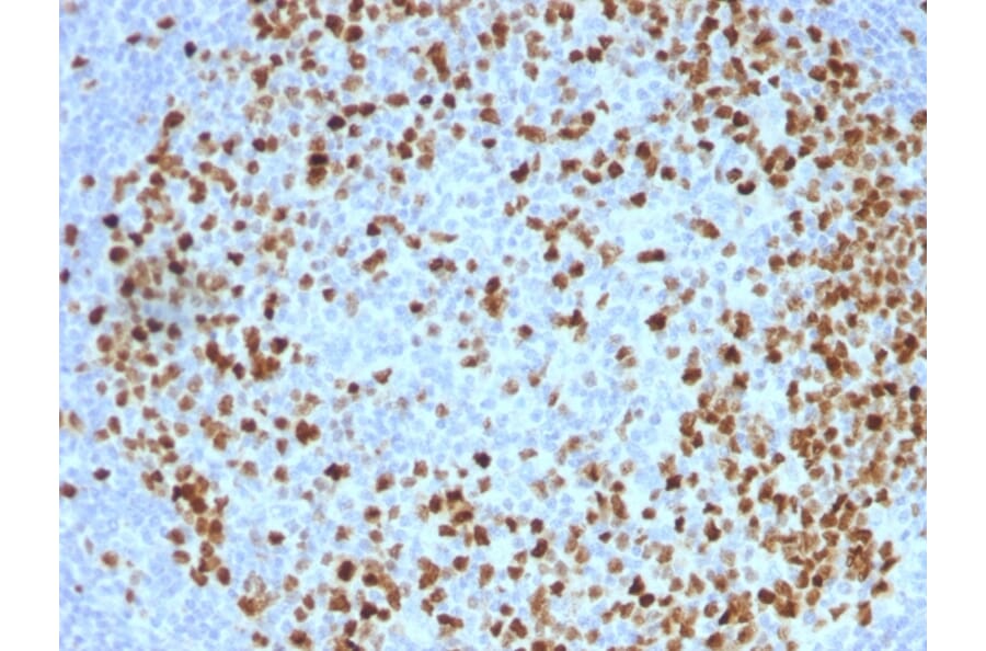 Immunohistochemistry - Anti-Topoisomerase II alpha Antibody [TOP2A/1362] - BSA and Azide free (A253349) - Antibodies.com