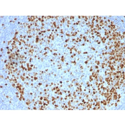 Immunohistochemistry - Anti-Topoisomerase II alpha Antibody [TOP2A/1362] - BSA and Azide free (A253349) - Antibodies.com