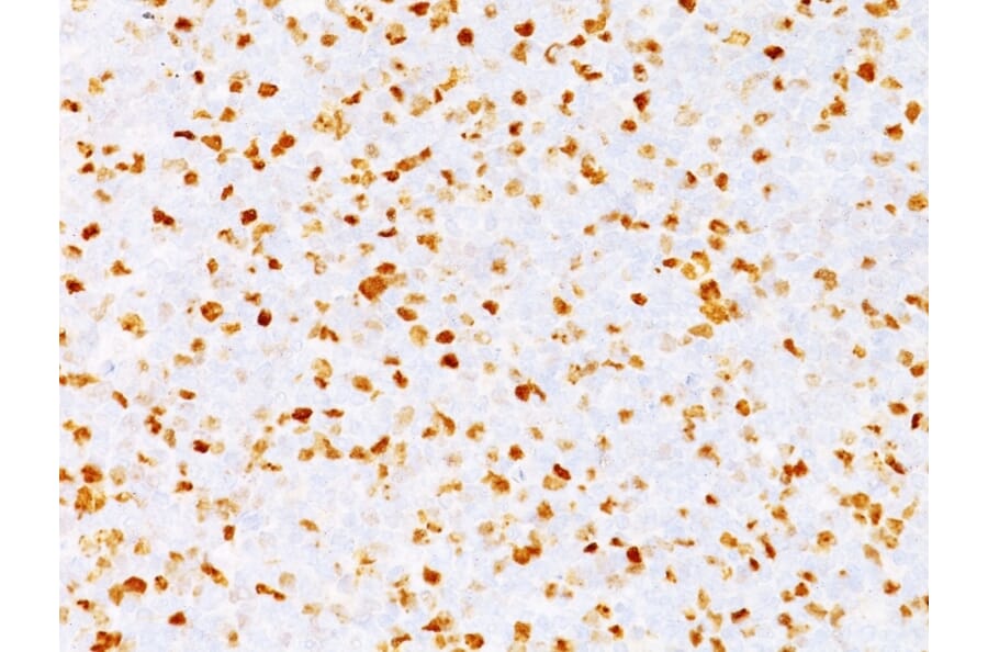 Immunohistochemistry - Anti-Topoisomerase II alpha Antibody [TOP2A/1362] - BSA and Azide free (A253349) - Antibodies.com