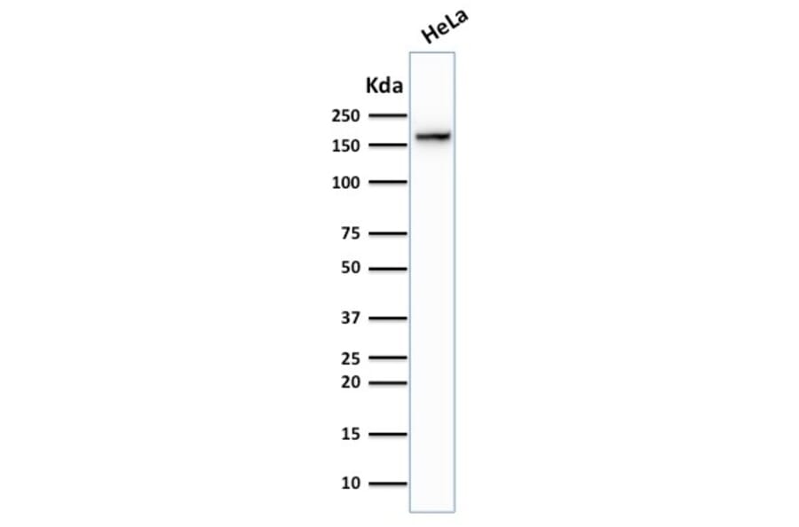 Western Blot - Anti-Topoisomerase II alpha Antibody [TOP2A/1362] - BSA and Azide free (A253349) - Antibodies.com