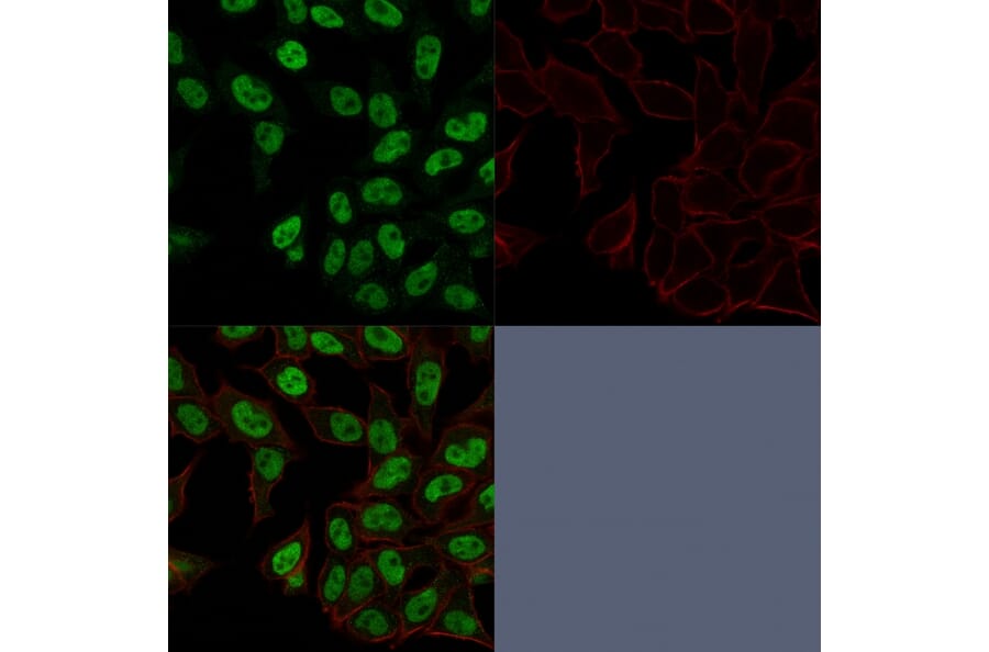 Immunofluorescence - Anti-Topoisomerase II alpha Antibody [TOP2A/1362] - BSA and Azide free (A253349) - Antibodies.com