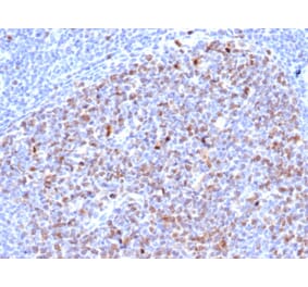 Immunohistochemistry - Anti-Topoisomerase II alpha Antibody [rTOP2A/6629] - BSA and Azide free (A253350) - Antibodies.com