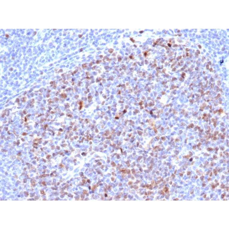 Immunohistochemistry - Anti-Topoisomerase II alpha Antibody [rTOP2A/6629] - BSA and Azide free (A253350) - Antibodies.com