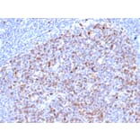 Immunohistochemistry - Anti-Topoisomerase II alpha Antibody [rTOP2A/6629] - BSA and Azide free (A253350) - Antibodies.com