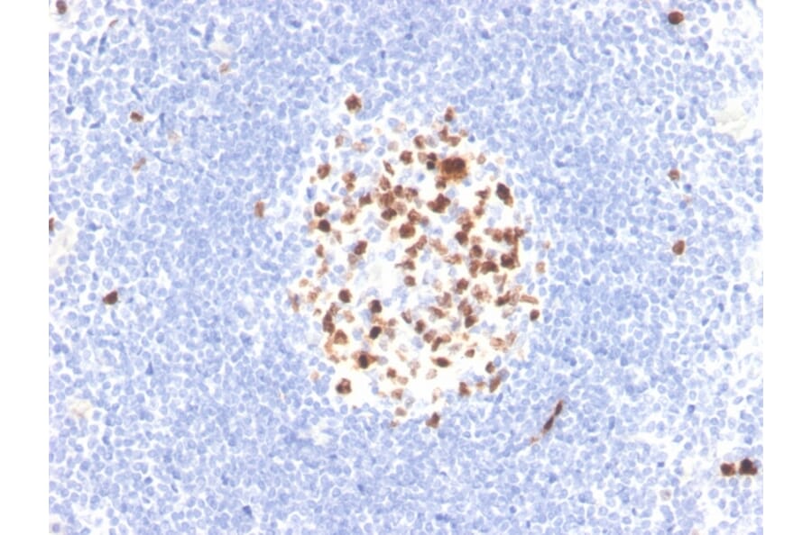 Immunohistochemistry - Anti-Topoisomerase II alpha Antibody [TOP2A/4397R] - BSA and Azide free (A250171) - Antibodies.com