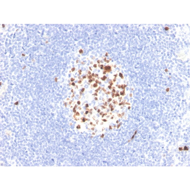 Immunohistochemistry - Anti-Topoisomerase II alpha Antibody [TOP2A/4397R] - BSA and Azide free (A250171) - Antibodies.com