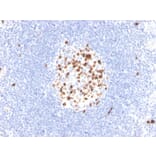 Immunohistochemistry - Anti-Topoisomerase II alpha Antibody [TOP2A/4397R] - BSA and Azide free (A250171) - Antibodies.com