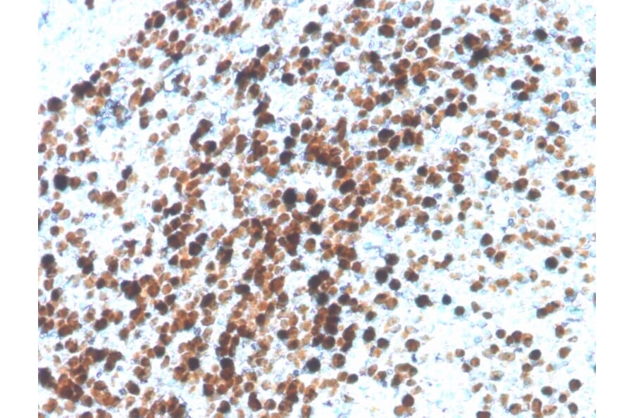 Immunohistochemistry - Anti-Topoisomerase II alpha Antibody [TOP2A/4397R] - BSA and Azide free (A250171) - Antibodies.com