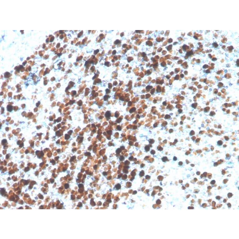 Immunohistochemistry - Anti-Topoisomerase II alpha Antibody [TOP2A/4397R] - BSA and Azide free (A250171) - Antibodies.com