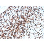 Immunohistochemistry - Anti-Topoisomerase II alpha Antibody [TOP2A/4397R] - BSA and Azide free (A250171) - Antibodies.com